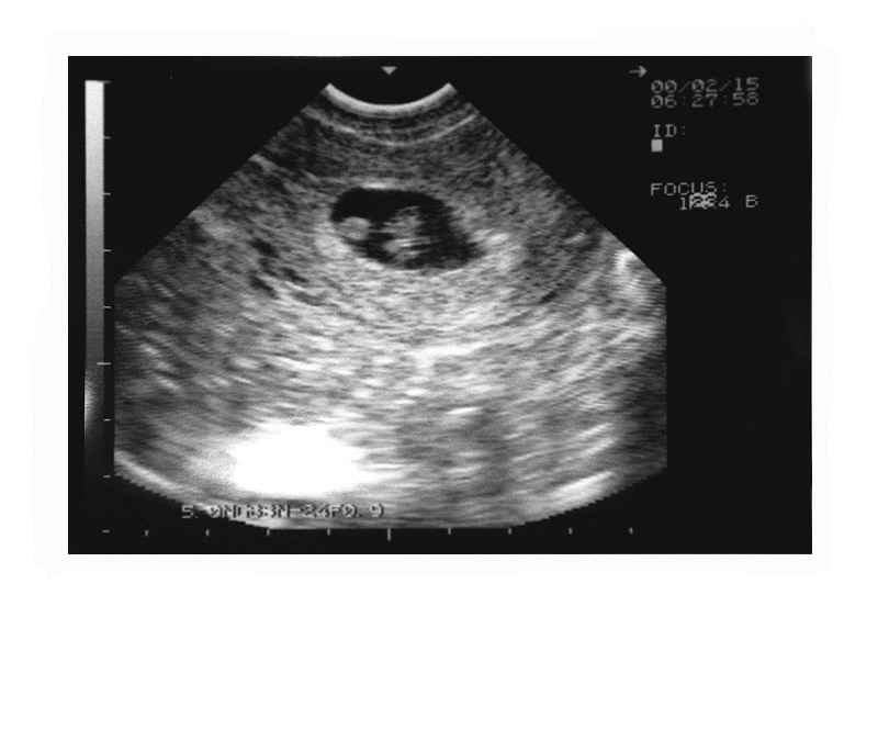 baby1
