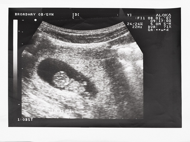 baby2