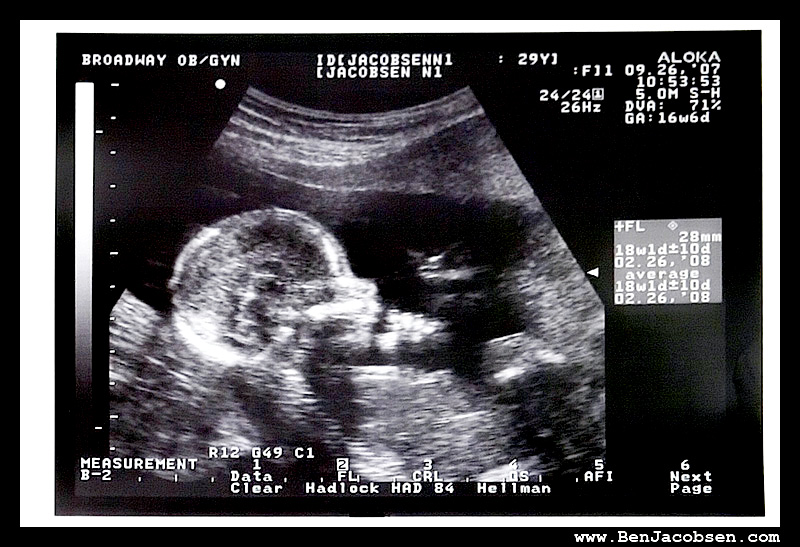 baby4