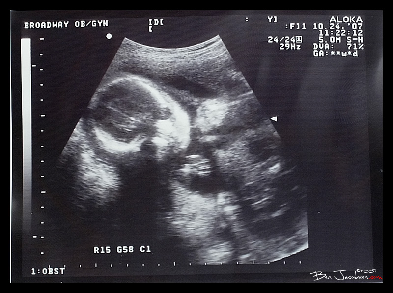 baby5