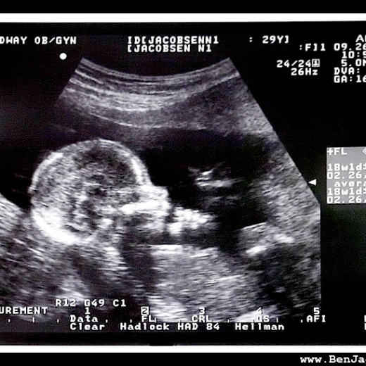 16 week baby update!